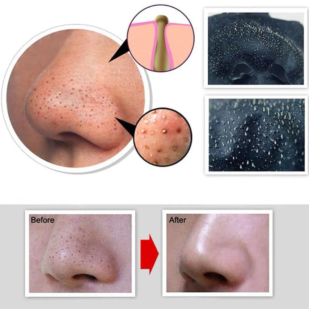 Amazing Blackhead Removal Deep Cleaning Face Mask It's WONDERFUL