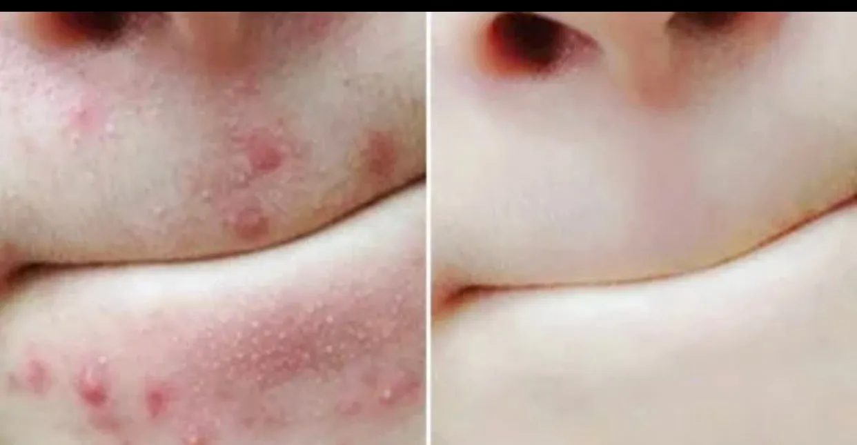 Fresh Face Cleansing Bar 