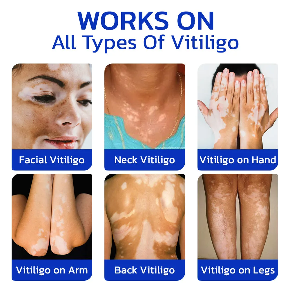GFOUK FastgoVitiligo Soothing Serum